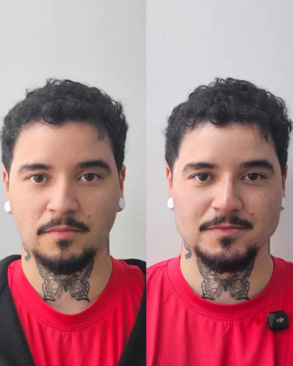 Prometeo - Masculinización facial - Imagen 2