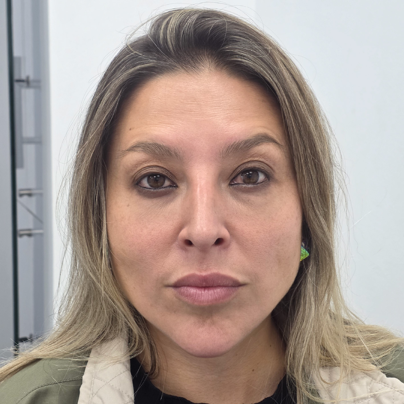antes y despues lifting-06